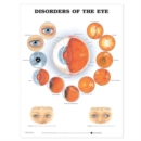 Image for Disorders of the Eye
