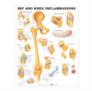 Image for Hip and Knee Inflammations
