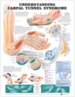 Image for Understanding Carpal Tunnel Syndrome Anatomical Chart