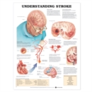 Image for Understanding Stroke Anatomical Chart