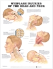 Image for Whiplash Injuries of the Head and Neck Anatomical Chart