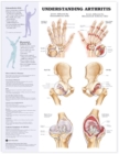 Image for Understanding Arthritis Anatomical Chart