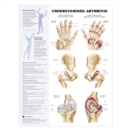 Image for Understanding Arthritis Anatomical Chart