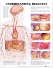 Image for Understanding Diabetes Anatomical Chart