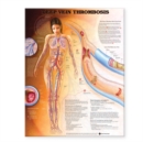 Image for Deep Vein Thrombosis Anatomical Chart