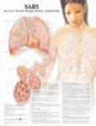 Image for SARS: Severe Acute Respiratory Syndrome Anatomical Chart