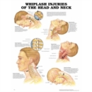 Image for Whiplash Injuries of the Head and Neck Anatomical Chart