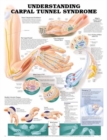 Image for Understanding Carpal Tunnel Syndrome Anatomical Chart