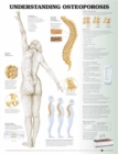 Image for Understanding Osteoporosis Anatomical Chart