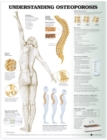 Image for Understanding Osteoporosis Anatomical Chart