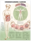 Image for Understanding Cancer Anatomical Chart