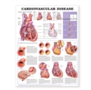 Image for Cardiovascular Disease Anatomical Chart