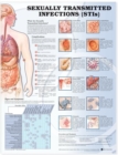 Image for Sexually Transmitted Infections Anatomical Chart