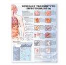 Image for Sexually Transmitted Infections Anatomical Chart