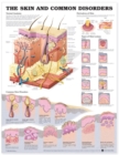 Image for The Skin and Common Disorders Anatomical Chart