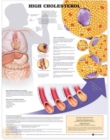 Image for High Cholesterol Anatomical Chart