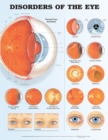 Image for Disorders of the Eye Anatomical Chart