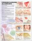 Image for Understanding Allergies Anatomical Chart