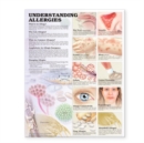 Image for Understanding Allergies Anatomical Chart