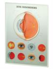 Image for Eye Disorders: 3D Lenticular Chart