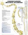 Image for Understanding Multiple Sclerosis Anatomical Chart