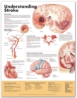 Image for Understanding Stroke Anatomical Chart