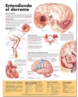 Image for Understanding Stroke Anatomical Chart in Spanish (Entendiendo que es un derrame)