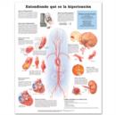 Image for Understanding Hypertension Anatomical Chart in Spanish (Entendiendo Que Es La Hypertension)