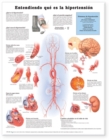 Image for Understanding Hypertension Anatomical Chart in Spanish (Entendiendo Que Es la Hypertension)