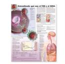 Image for Understanding HIV and AIDS Anatomical Chart in Spanish (Entendiendo Que Son el VIH y el SIDA)
