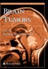 Image for Brain tumors