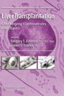 Image for Liver transplantation  : challenging controversies and topics