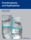 Image for Vertebroplasty and Kyphoplasty