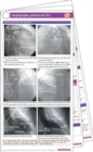 Image for Angiography Pocketcard Set