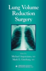 Image for Lung volume reduction surgery