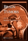 Image for Brain tumors