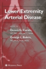 Image for Lower extremity arterial disease