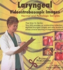 Image for Laryngeal Videostroboscopic Images