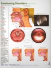Image for Swallowing Disorders