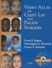 Image for Video Atlas of Cleft Lip and  Palate Surgery
