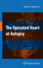 Image for The operated heart at autopsy
