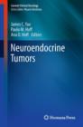 Image for Neuroendocrine tumors