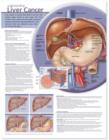 Image for Understanding Liver Cancer Anatomical Chart