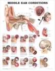 Image for Middle Ear Conditions Anatomical Chart