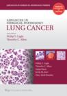 Image for Advances in Surgical Pathology: Lung Cancer
