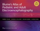 Image for Blume&#39;s Atlas of Pediatric and Adult Electroencephalography