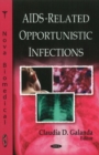 Image for AIDS-Related Opportunistic Infections