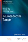 Image for Neuroendocrine Tumors