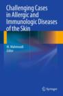 Image for Challenging Cases in Allergic and Immunologic Diseases of the Skin