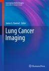 Image for Lung Cancer Imaging